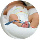 Prematuros Se considera un bebé prematuro cuando este nace antes de la semana 37 y/o presenta muy bajo peso. En ocasiones estos niños pueden presentar alteraciones a lo largo de su desarrollo.